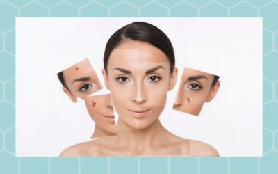 What your face says about your health…
